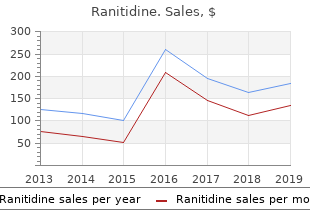 generic ranitidine 150 mg overnight delivery