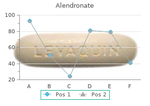 buy generic alendronate 70 mg on line