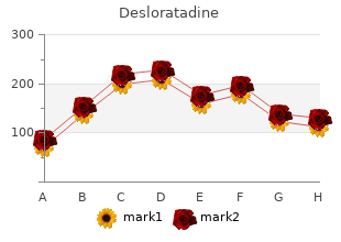 desloratadine 5 mg fast delivery
