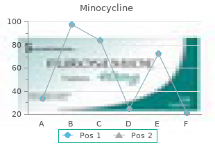buy minocycline 50 mg mastercard