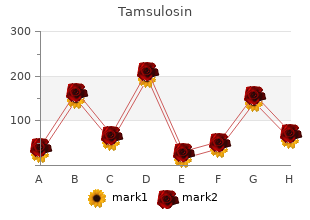 generic tamsulosin 0.2mg with mastercard