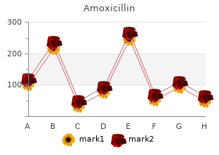 generic 500 mg amoxicillin amex