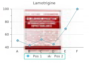generic 200 mg lamotrigine with visa