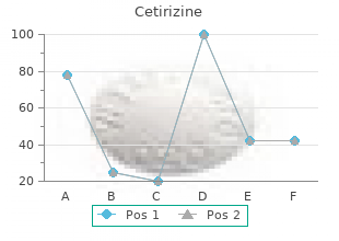 generic cetirizine 10 mg mastercard