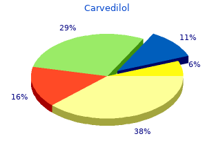 generic carvedilol 25mg fast delivery