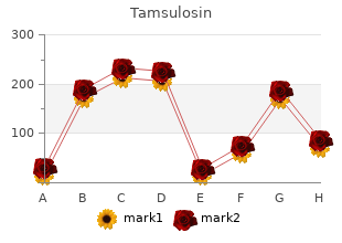 buy discount tamsulosin 0.2mg on line