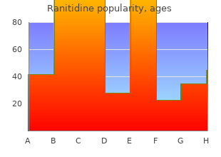 ranitidine 150 mg line