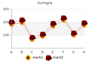 buy generic aurogra 100mg on-line
