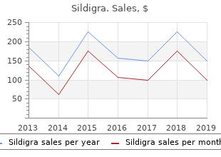 purchase sildigra 50mg free shipping