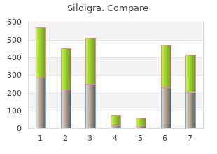 order sildigra 50mg with mastercard