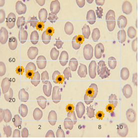Dyserythropoietic anemia, congenital type 2