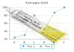 buy 100 mg kamagra gold with mastercard