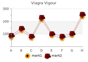 order 800 mg viagra vigour visa
