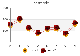 finasteride 1 mg with mastercard