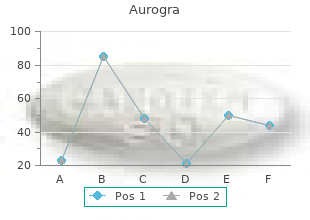 cheap 100 mg aurogra with mastercard