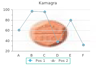 50 mg kamagra with mastercard