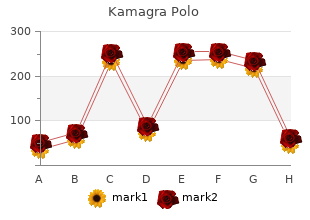 order 100mg kamagra polo with mastercard