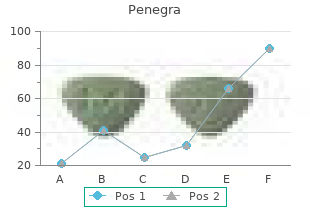 penegra 50mg without a prescription