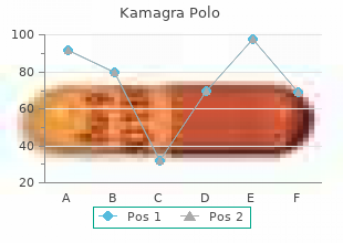 cheap kamagra polo 100mg with amex
