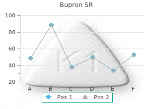 buy bupron sr 150 mg on line