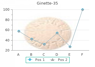 best order ginette-35