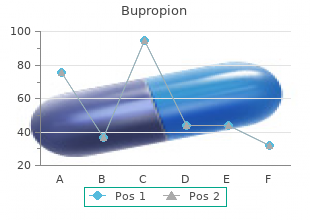 bupropion 150 mg with mastercard