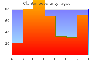 claritin 10mg on-line
