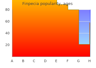 purchase finpecia 1 mg line