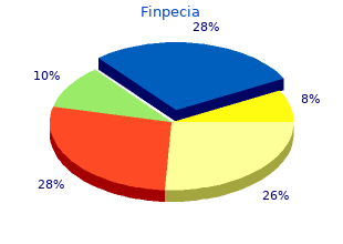 discount finpecia 1 mg without prescription