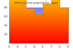 order generic minocycline on line